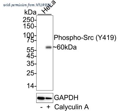 HUABIO ET1609-15 image 1