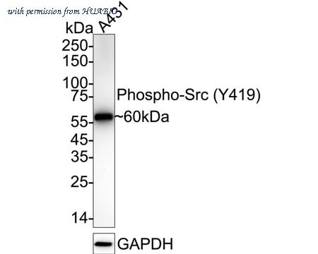 HUABIO ET1609-15 image 2