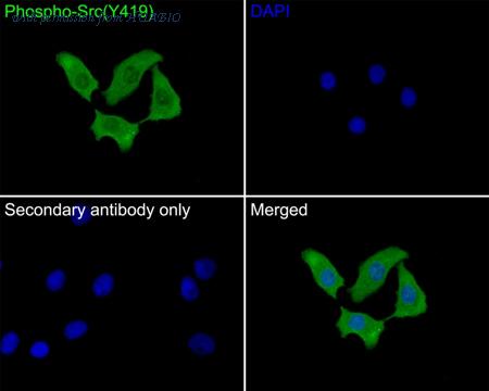 HUABIO ET1609-15 image 3