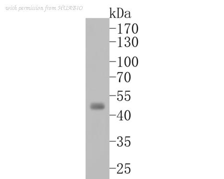 HUABIO ET1609-22 image 1
