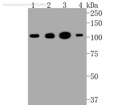 HUABIO ET1609-28 image 2