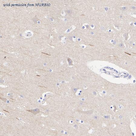 HUABIO ET1609-36 image 2