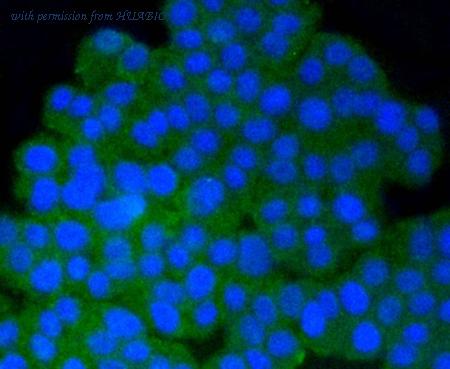 HUABIO ET1609-40 image 2