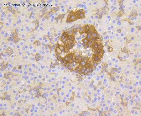 HUABIO ET1609-40 image 3