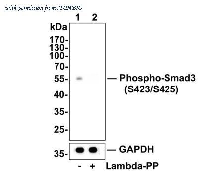 HUABIO ET1609-41 image 2