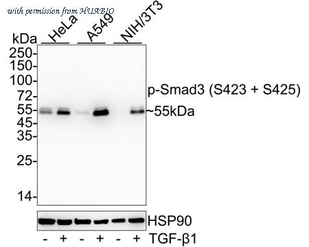 HUABIO ET1609-41 image 3