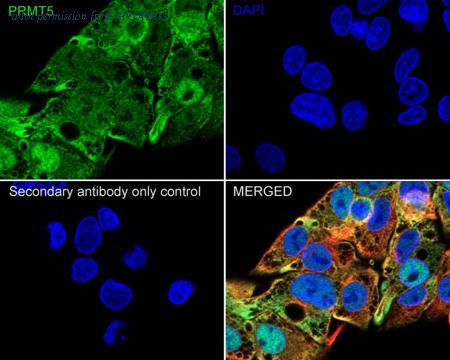 HUABIO ET1609-43 image 2