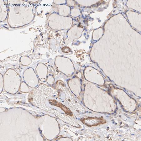 HUABIO ET1609-53 image 2