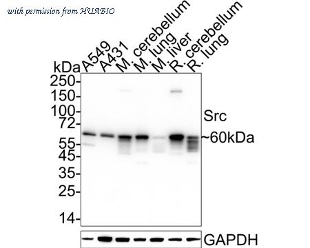 HUABIO ET1609-65 image 2