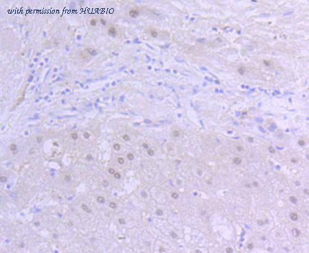 HUABIO ET1609-67 image 3