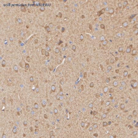 HUABIO ET1609-72 image 3