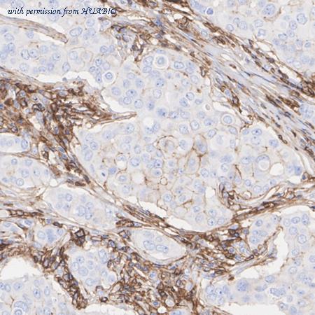 HUABIO ET1609-74 image 2