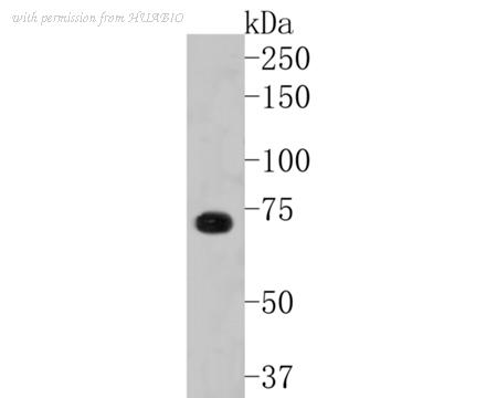 HUABIO ET1609-80 image 2