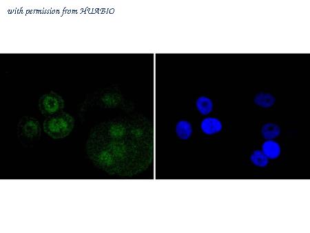 HUABIO ET1609-80 image 3