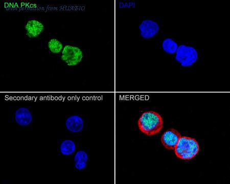 HUABIO ET1610-12-50UL image 2