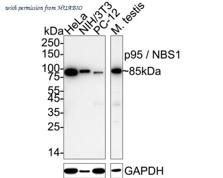 HUABIO ET1610-26 image 1