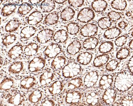 HUABIO ET1610-26 image 2