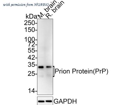 HUABIO ET1610-27 image 1