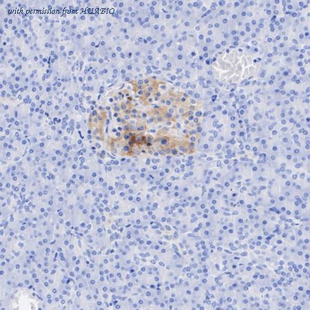 HUABIO ET1610-27 image 2