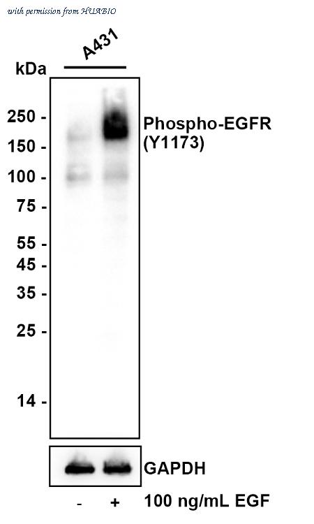 HUABIO ET1610-4 image 1