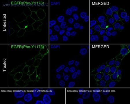 HUABIO ET1610-4 image 2