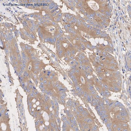 HUABIO ET1610-67 image 2