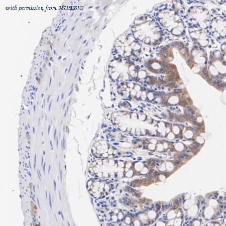 HUABIO ET1610-67 image 3