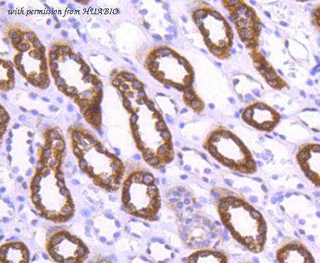 HUABIO ET1610-69 image 2