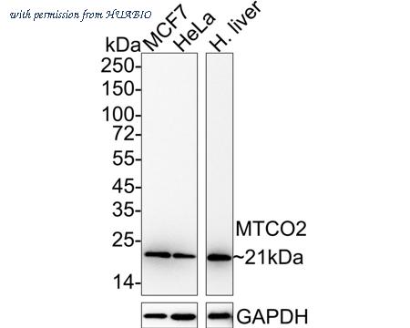 HUABIO ET1610-72 image 1