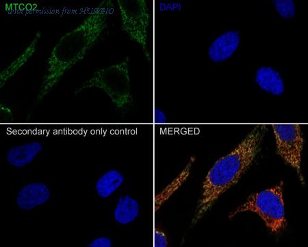 HUABIO ET1610-72 image 2