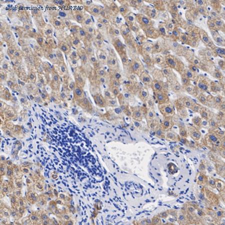 HUABIO ET1610-72 image 3