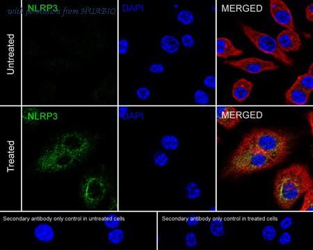 HUABIO ET1610-93-50UL image 2