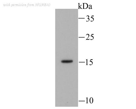HUABIO ET1611-13 image 2