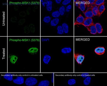 HUABIO ET1611-17 image 1
