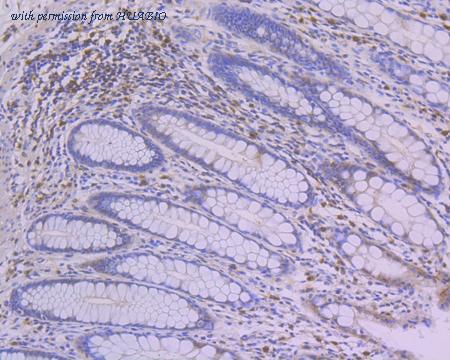 HUABIO ET1611-17 image 2