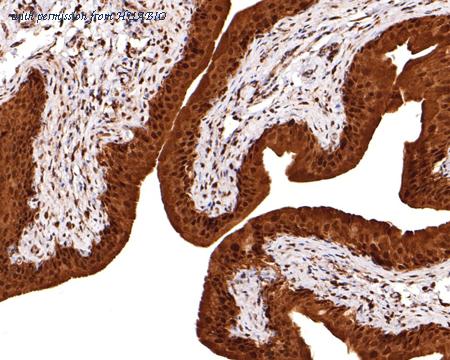 HUABIO ET1611-17 image 3