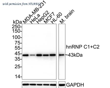 HUABIO ET1611-2 image 1