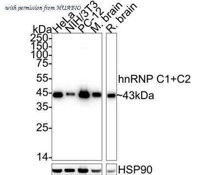 HUABIO ET1611-2 image 2