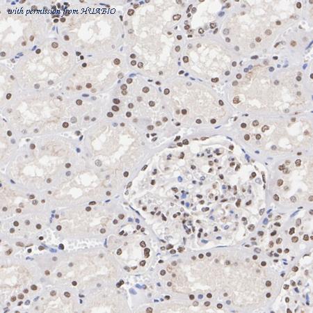 HUABIO ET1611-2 image 3