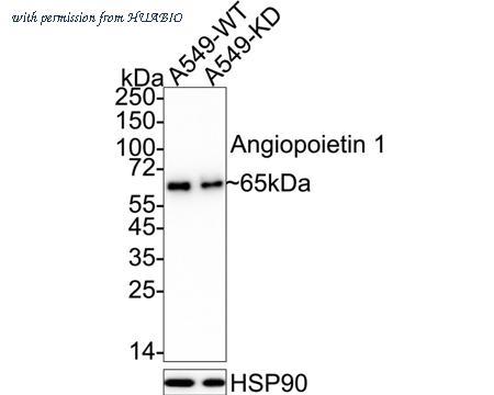 HUABIO ET1611-28 image 2