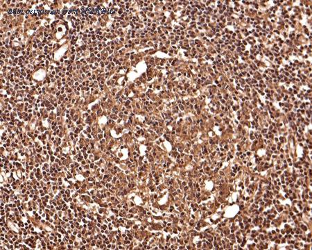 HUABIO ET1611-39 image 3