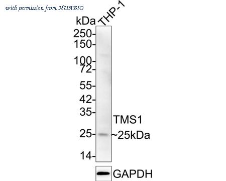 HUABIO ET1611-62 image 1