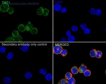 HUABIO ET1611-62 image 2