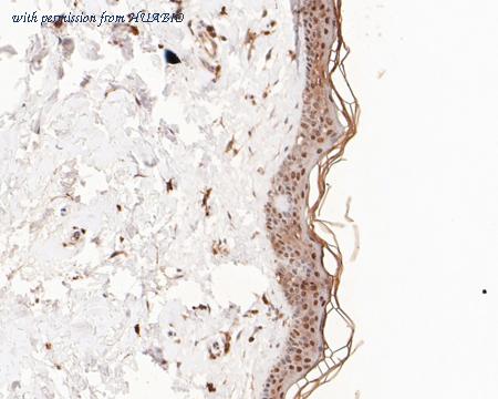 HUABIO ET1611-62 image 3