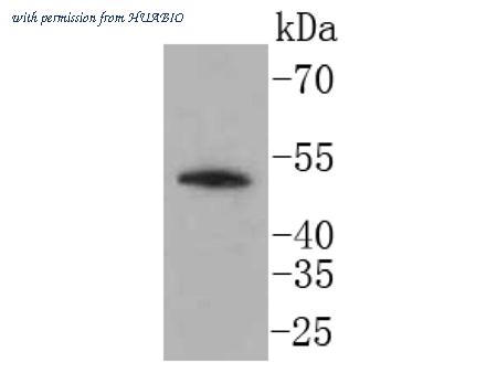 HUABIO ET1611-9 image 1