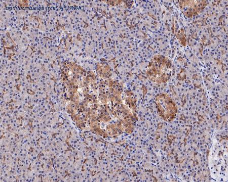 HUABIO ET1611-95 image 3