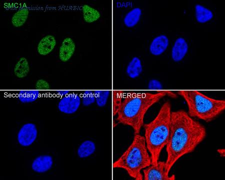 HUABIO ET1611-97 image 2