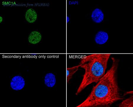 HUABIO ET1611-97 image 3