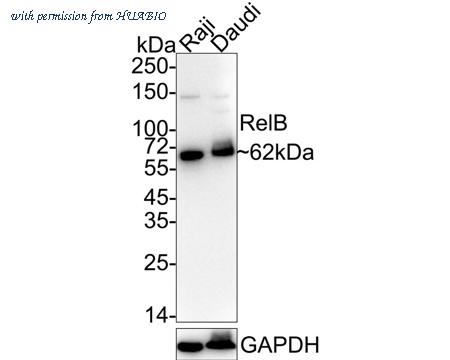 HUABIO ET1612-18 image 1