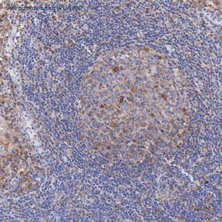 HUABIO ET1612-18 image 2